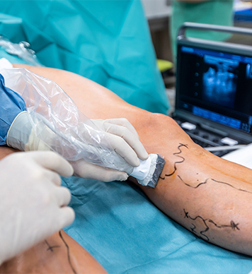 Vascular Surgery